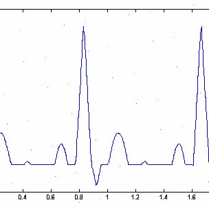 ECG-Signal-Components-a-A-typical-ECG-signals-including-PQRS-T-morphology-b-Test_Q320